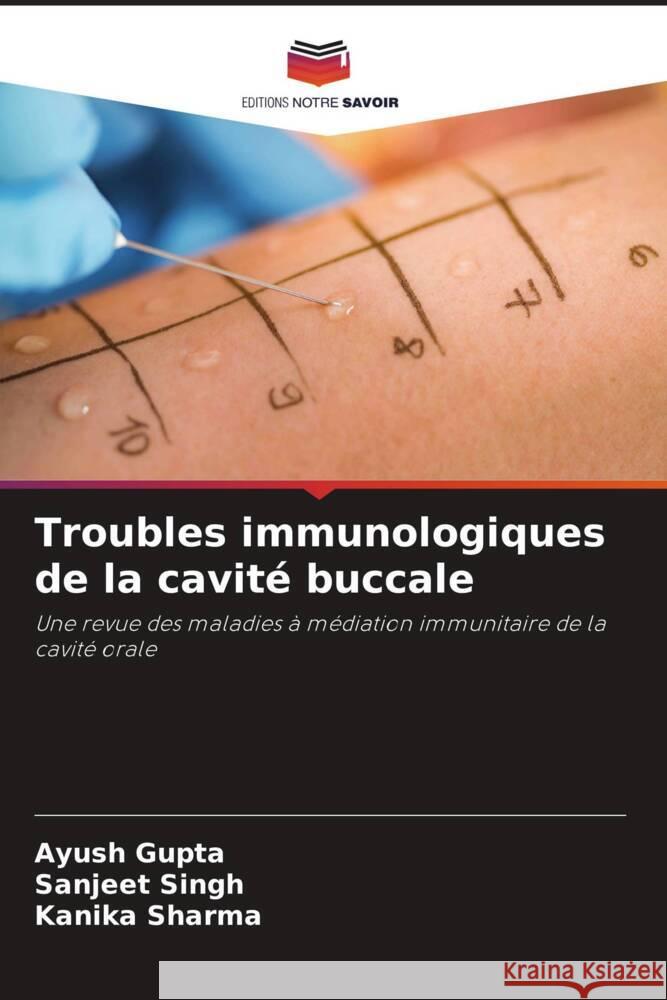 Troubles immunologiques de la cavité buccale Gupta, Ayush, Singh, Sanjeet, Sharma, Kanika 9786204703015