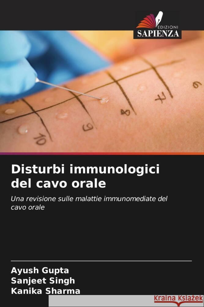 Disturbi immunologici del cavo orale Gupta, Ayush, Singh, Sanjeet, Sharma, Kanika 9786204703022