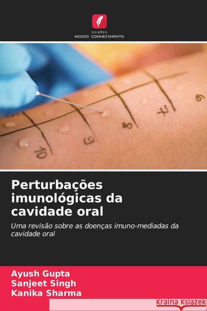 Perturbações imunológicas da cavidade oral Gupta, Ayush, Singh, Sanjeet, Sharma, Kanika 9786204703039