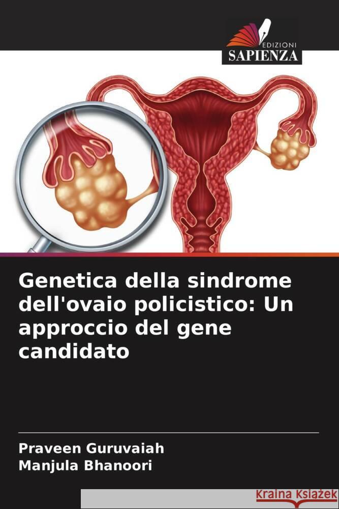 Genetica della sindrome dell'ovaio policistico: Un approccio del gene candidato Guruvaiah, Praveen, Bhanoori, Manjula 9786204706764