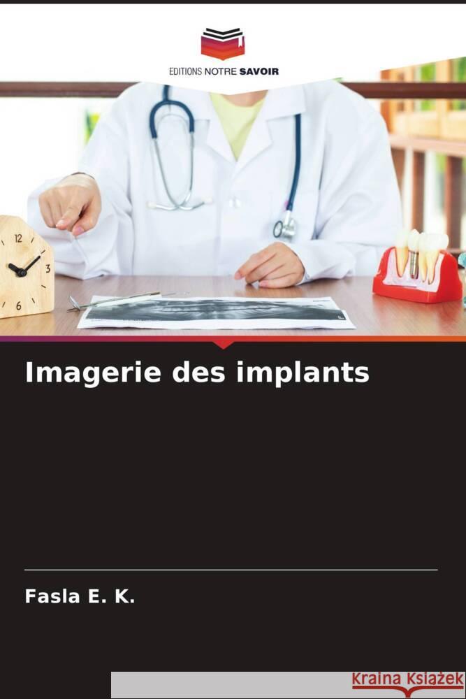 Imagerie des implants E. K., Fasla 9786204707006 Editions Notre Savoir