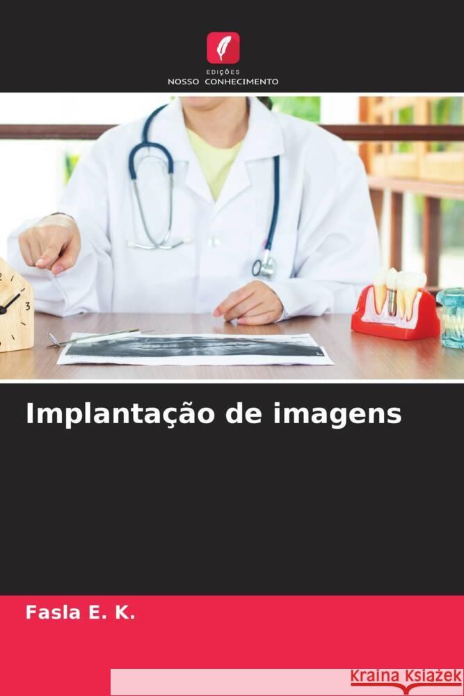 Implantação de imagens E. K., Fasla 9786204707020 Edições Nosso Conhecimento