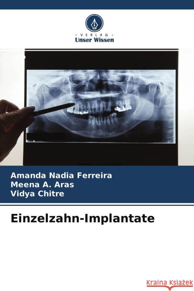 Einzelzahn-Implantate Ferreira, Amanda Nadia, A. Aras, Meena, Chitre, Vidya 9786204707099