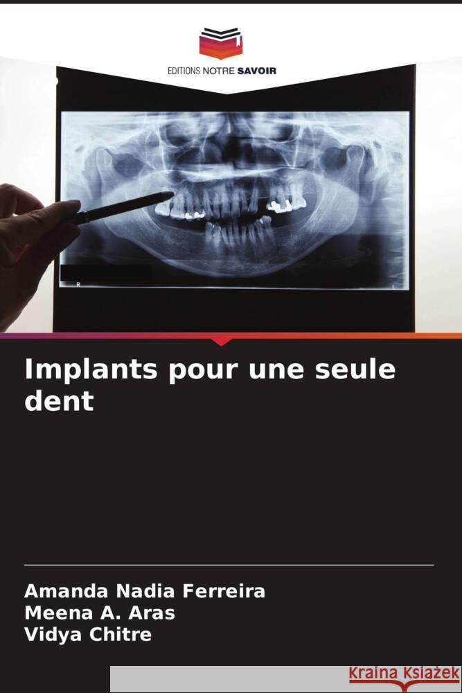 Implants pour une seule dent Ferreira, Amanda Nadia, A. Aras, Meena, Chitre, Vidya 9786204707136