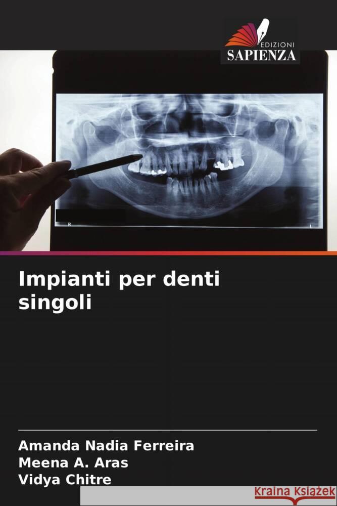 Impianti per denti singoli Ferreira, Amanda Nadia, A. Aras, Meena, Chitre, Vidya 9786204707150