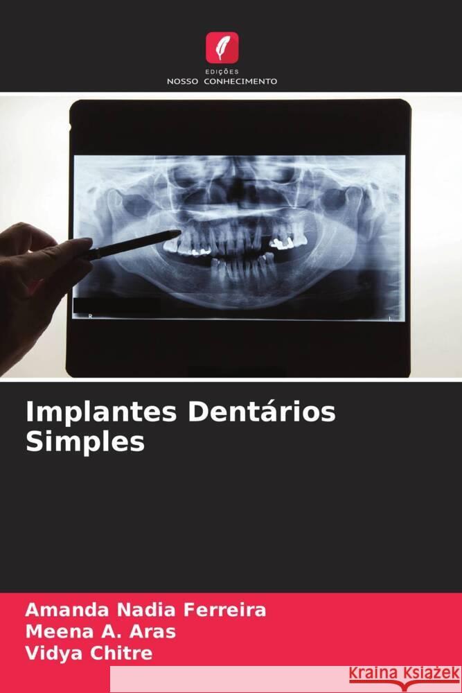 Implantes Dentários Simples Ferreira, Amanda Nadia, A. Aras, Meena, Chitre, Vidya 9786204707365