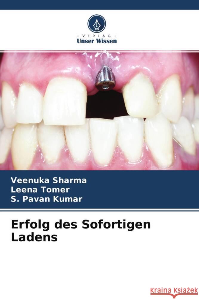 Erfolg des Sofortigen Ladens Sharma, Veenuka, Tomer, Leena, Kumar, S. Pavan 9786204708515 Verlag Unser Wissen