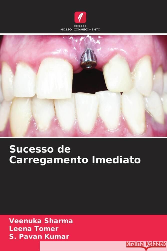 Sucesso de Carregamento Imediato Sharma, Veenuka, Tomer, Leena, Kumar, S. Pavan 9786204708553 Edições Nosso Conhecimento