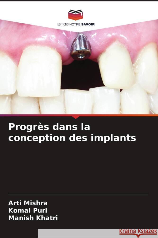 Progrès dans la conception des implants Mishra, Arti, Puri, Komal, Khatri, Manish 9786204709291