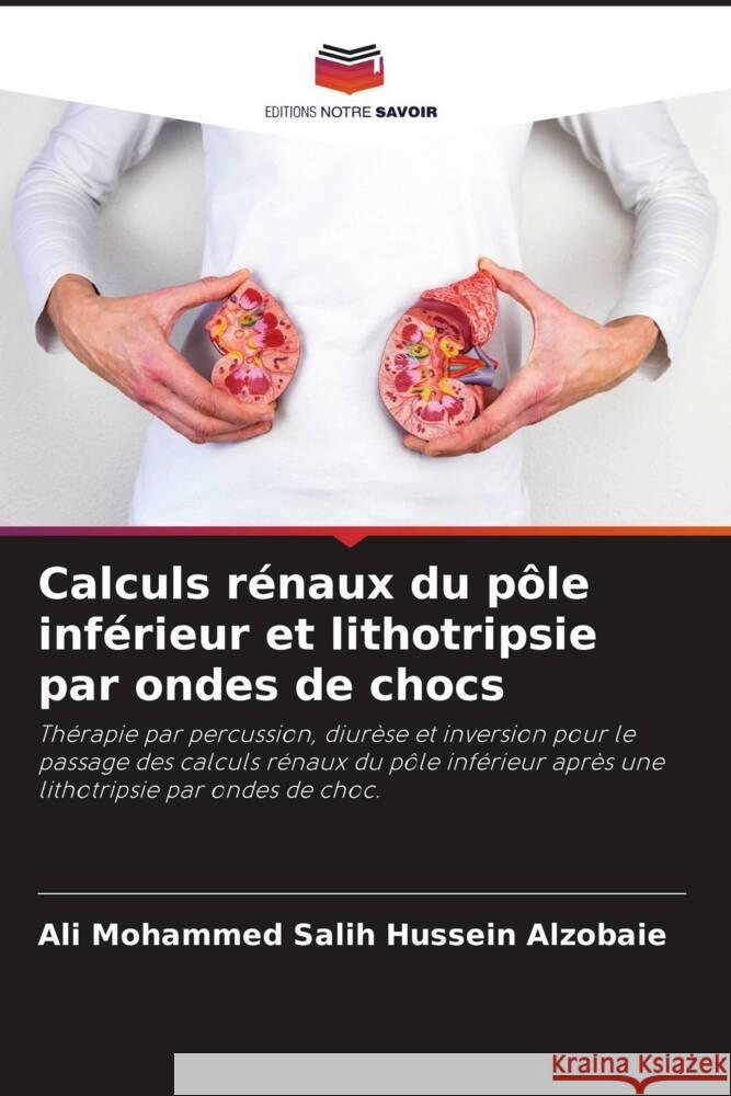 Calculs r?naux du p?le inf?rieur et lithotripsie par ondes de chocs Ali Mohammed Sali Nibbras Ibrahim Alhamdani 9786204712598