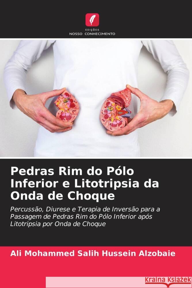 Pedras Rim do P?lo Inferior e Litotripsia da Onda de Choque Ali Mohammed Sali Nibbras Ibrahim Alhamdani 9786204712628