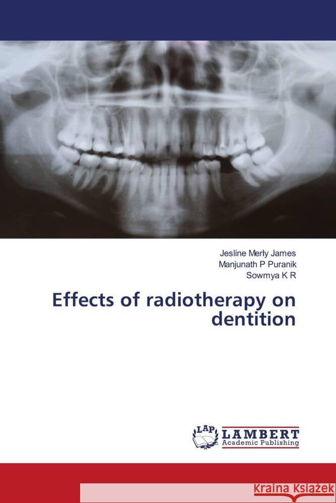 Effects of radiotherapy on dentition James, Jesline Merly, Puranik, Manjunath P, K R, Sowmya 9786204718880 LAP Lambert Academic Publishing