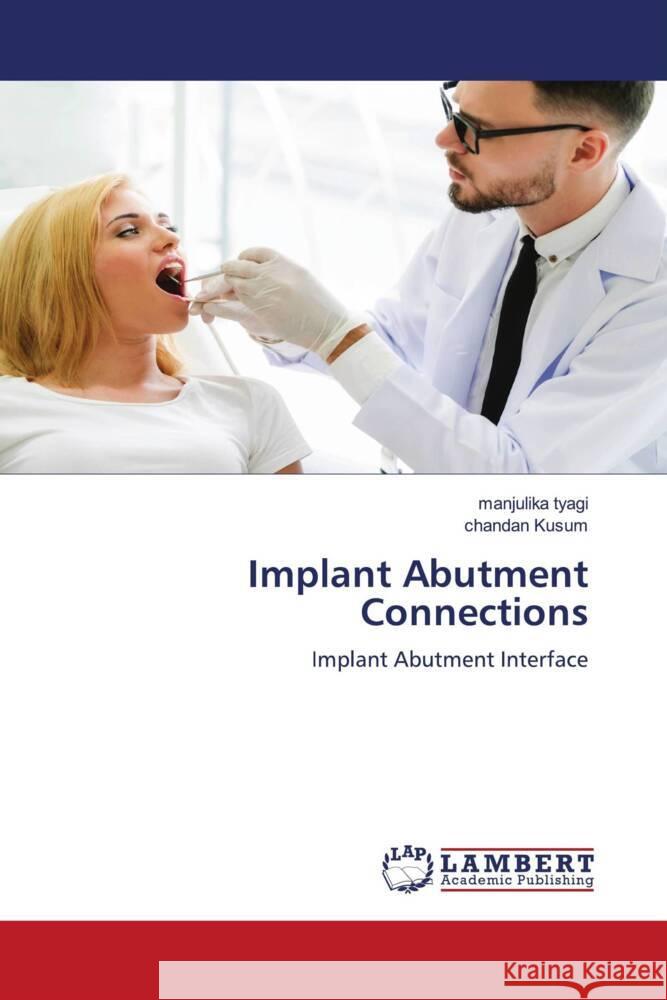 Implant Abutment Connections tyagi, manjulika, Kusum, chandan 9786204719023