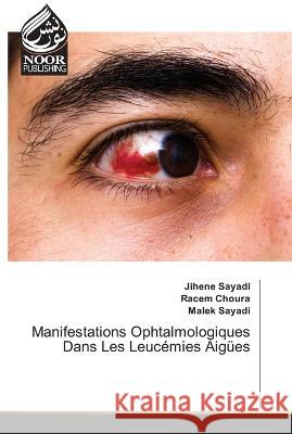Manifestations Ophtalmologiques Dans Les Leuc?mies Aig?es Jihene Sayadi Racem Choura Malek Sayadi 9786204723839