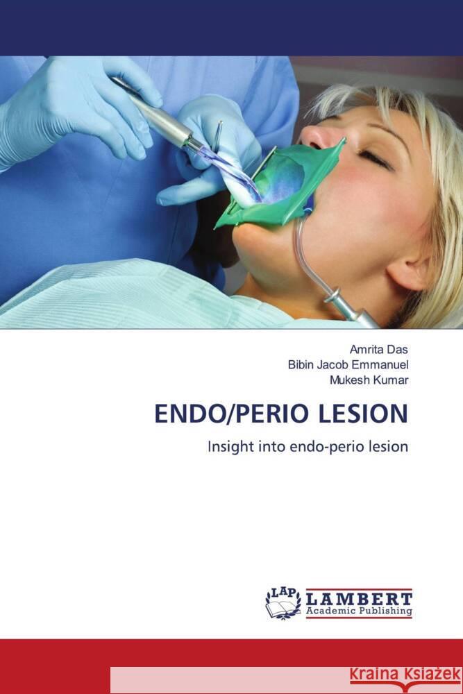 ENDO/PERIO LESION Das, Amrita, Emmanuel, Bibin Jacob, Kumar, Mukesh 9786204725253 LAP Lambert Academic Publishing