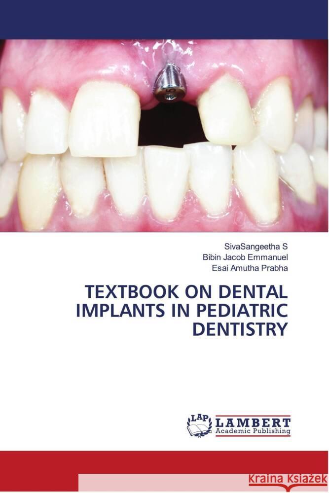 TEXTBOOK ON DENTAL IMPLANTS IN PEDIATRIC DENTISTRY S, SivaSangeetha, Emmanuel, Bibin Jacob, Prabha, Esai Amutha 9786204728254 LAP Lambert Academic Publishing