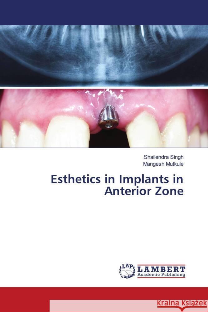 Esthetics in Implants in Anterior Zone Singh, Shailendra, Mutkule, Mangesh 9786204729602 LAP Lambert Academic Publishing