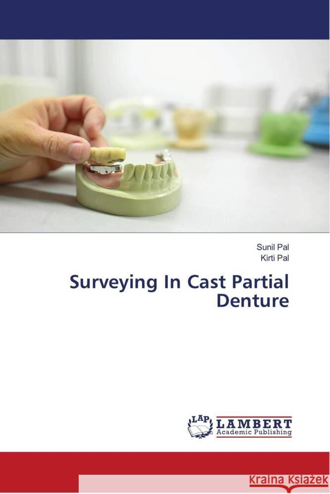 Surveying In Cast Partial Denture Pal, Sunil, Pal, Kirti 9786204730554 LAP Lambert Academic Publishing