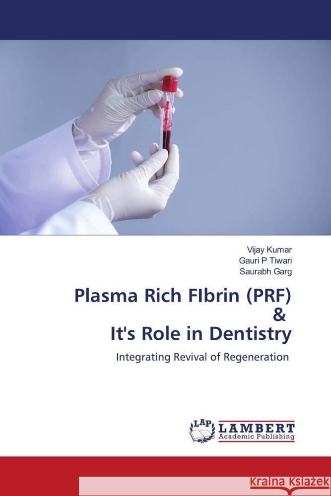 Plasma Rich FIbrin (PRF) & It's Role in Dentistry Kumar, Vijay, Tiwari, Gauri P, Garg, Saurabh 9786204731209