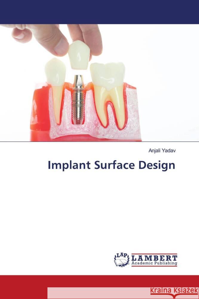 Implant Surface Design Yadav, Anjali 9786204731469 LAP Lambert Academic Publishing