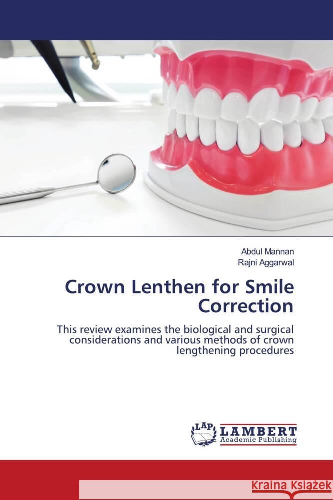 Crown Lenthen for Smile Correction Mannan, Abdul, Aggarwal, Rajni 9786204737225