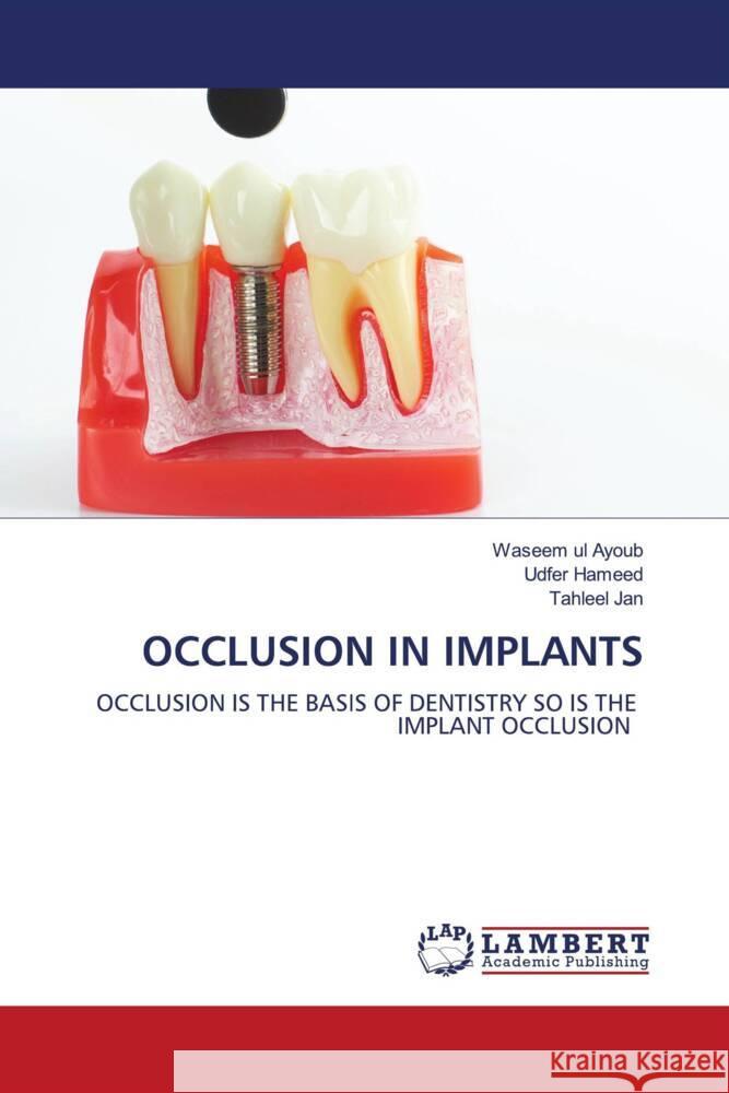 OCCLUSION IN IMPLANTS Ul Ayoub, Waseem, Hameed, Udfer, Jan, Tahleel 9786204737362