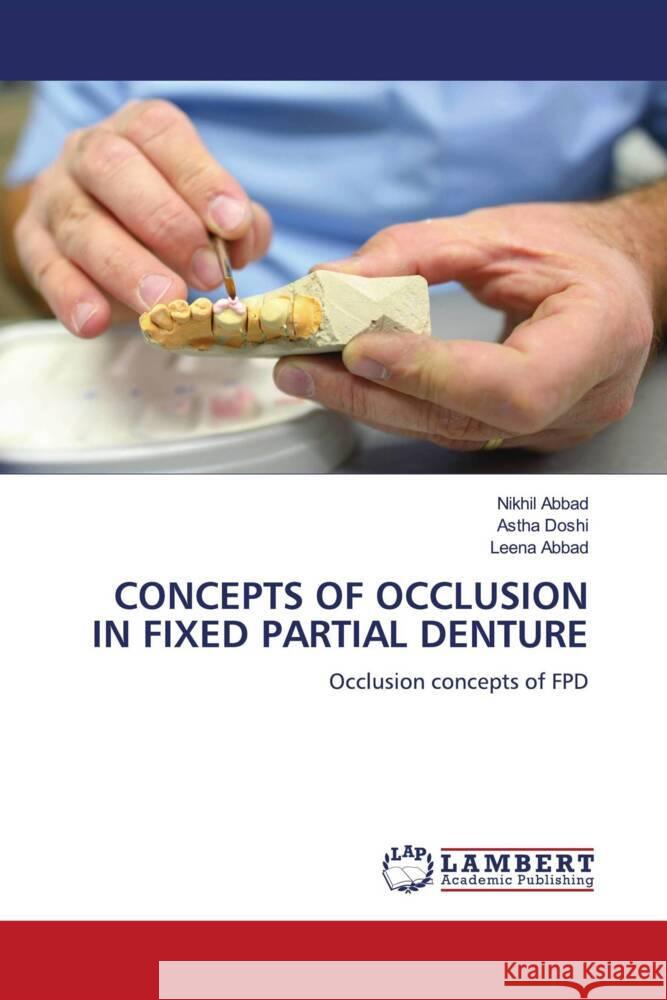 CONCEPTS OF OCCLUSION IN FIXED PARTIAL DENTURE Abbad, Nikhil, Doshi, Astha, Abbad, Leena 9786204737386