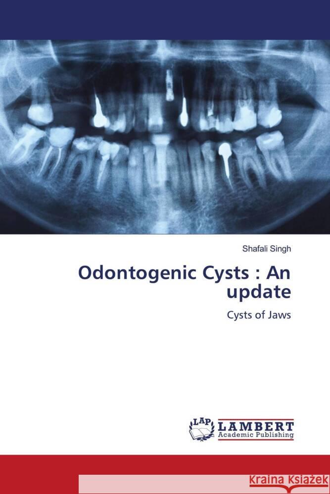 Odontogenic Cysts : An update Singh, Shafali 9786204737751