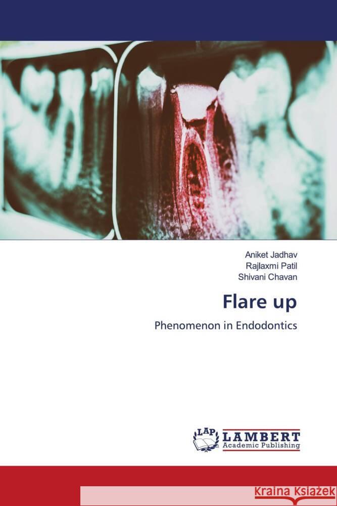 Flare up Jadhav, Aniket, Patil, Rajlaxmi, Chavan, Shivani 9786204739670 LAP Lambert Academic Publishing