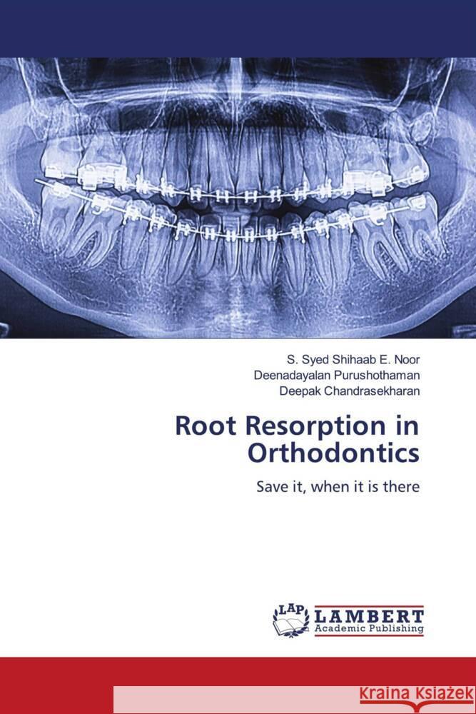 Root Resorption in Orthodontics Noor, S. Syed Shihaab E., Purushothaman, Deenadayalan, Chandrasekharan, Deepak 9786204741765