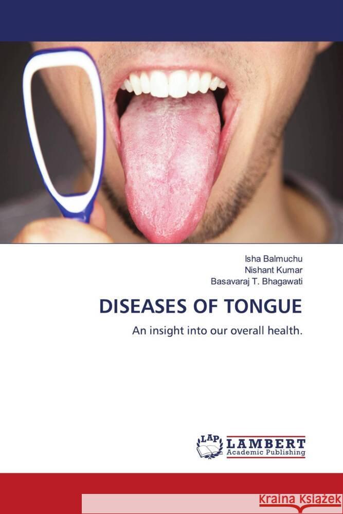 DISEASES OF TONGUE Balmuchu, Isha, Kumar, Nishant, Bhagawati, Basavaraj T. 9786204742250 LAP Lambert Academic Publishing