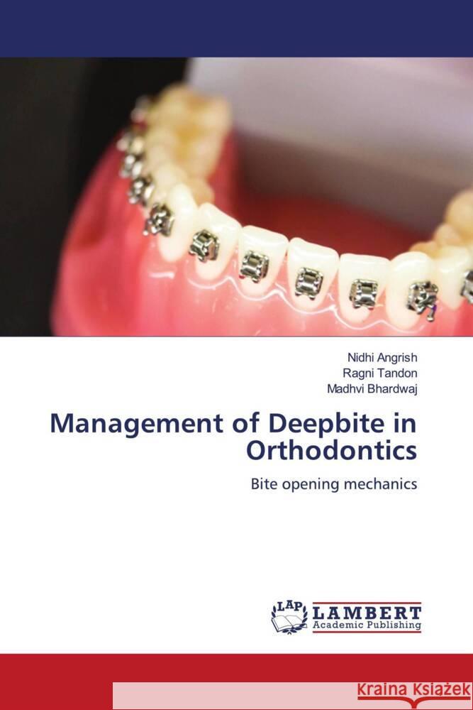 Management of Deepbite in Orthodontics Angrish, Nidhi, Tandon, Ragni, Bhardwaj, Madhvi 9786204743691 LAP Lambert Academic Publishing