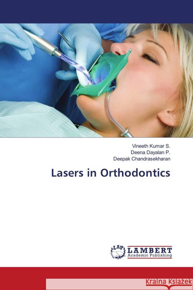 Lasers in Orthodontics Kumar S., Vineeth, Dayalan P., Deena, Chandrasekharan, Deepak 9786204743721 LAP Lambert Academic Publishing