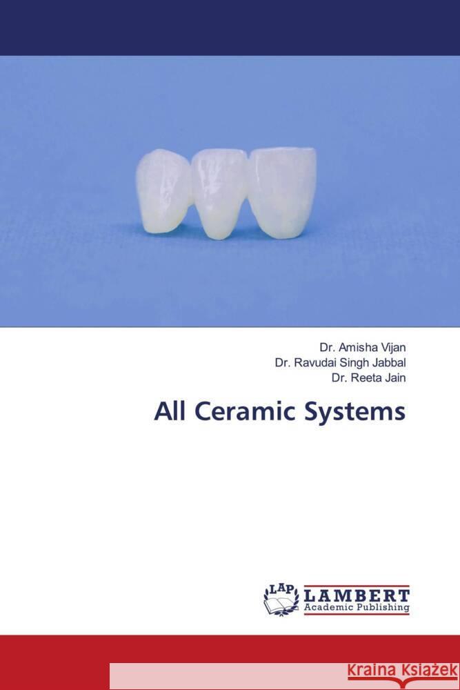 All Ceramic Systems Vijan, Dr. Amisha, Jabbal, Dr. Ravudai Singh, Jain, Dr. Reeta 9786204743912