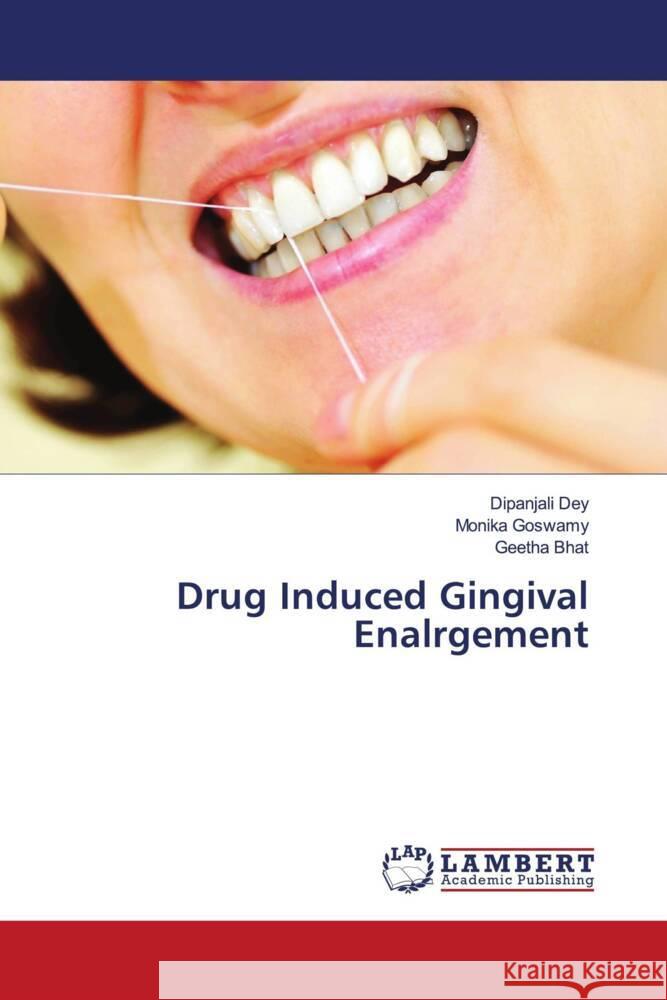 Drug Induced Gingival Enalrgement Dey, Dipanjali, Goswamy, Monika, Bhat, Geetha 9786204745558