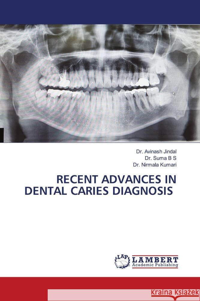 RECENT ADVANCES IN DENTAL CARIES DIAGNOSIS Jindal, Dr. Avinash, B S, Dr. Suma, Kumari, Dr. Nirmala 9786204748009 LAP Lambert Academic Publishing