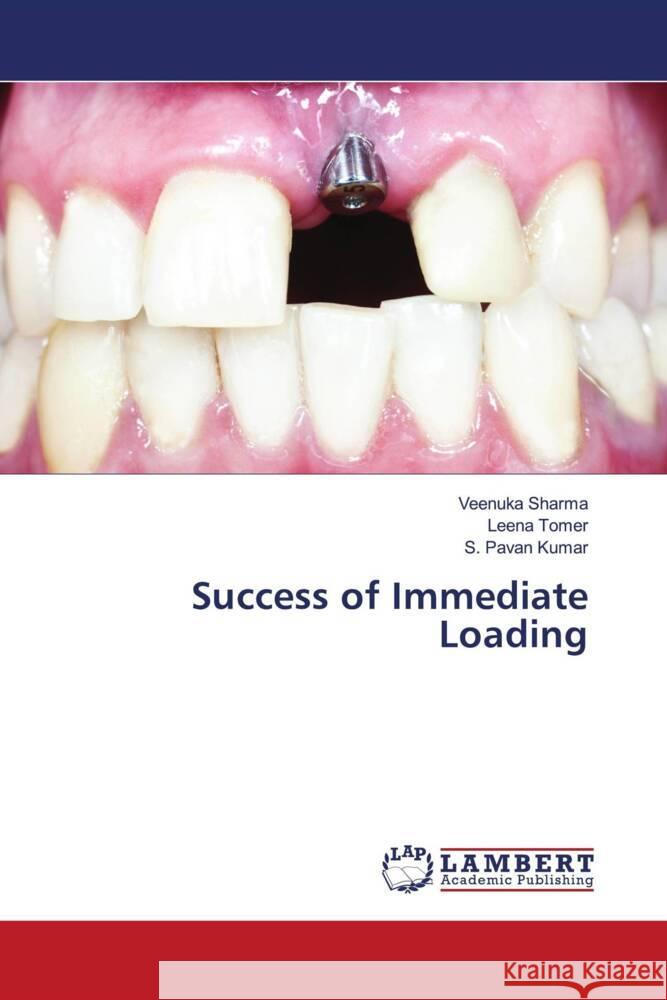 Success of Immediate Loading Sharma, Veenuka, Tomer, Leena, Kumar, S. Pavan 9786204748016 LAP Lambert Academic Publishing