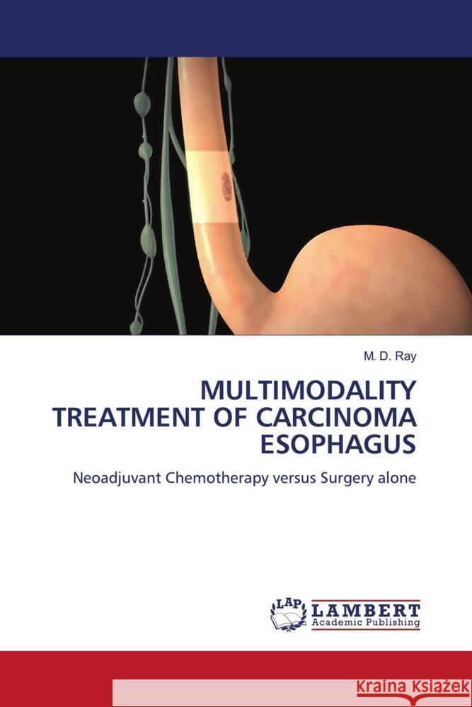 MULTIMODALITY TREATMENT OF CARCINOMA ESOPHAGUS Ray, M. D. 9786204749730 LAP Lambert Academic Publishing