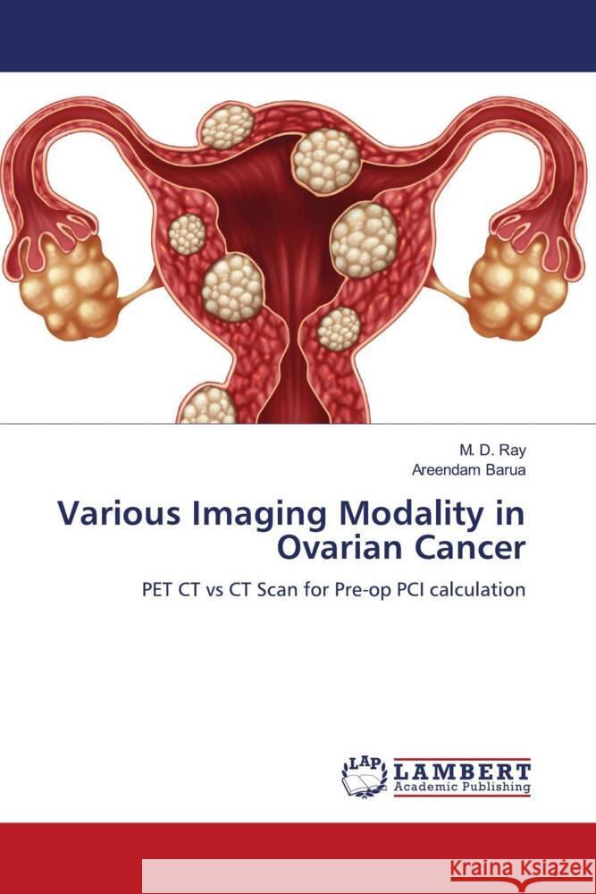 Various Imaging Modality in Ovarian Cancer Ray, M. D., Barua, Areendam 9786204749969 LAP Lambert Academic Publishing