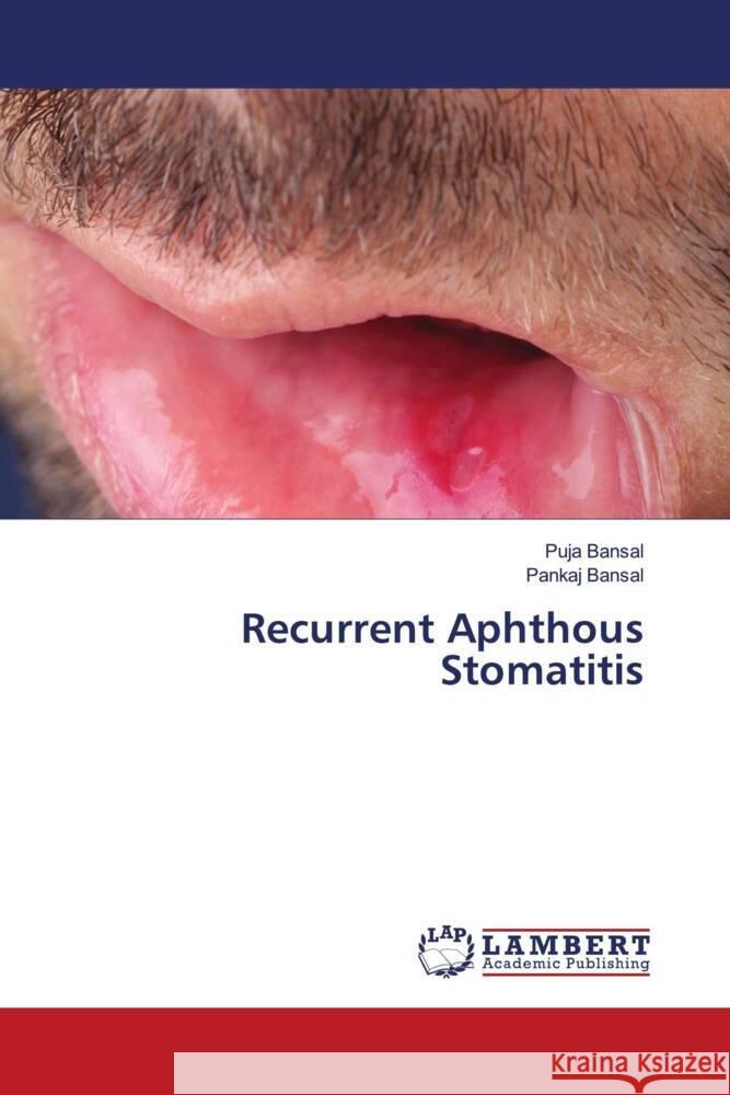 Recurrent Aphthous Stomatitis Bansal, Puja, Bansal, Pankaj 9786204750439 LAP Lambert Academic Publishing