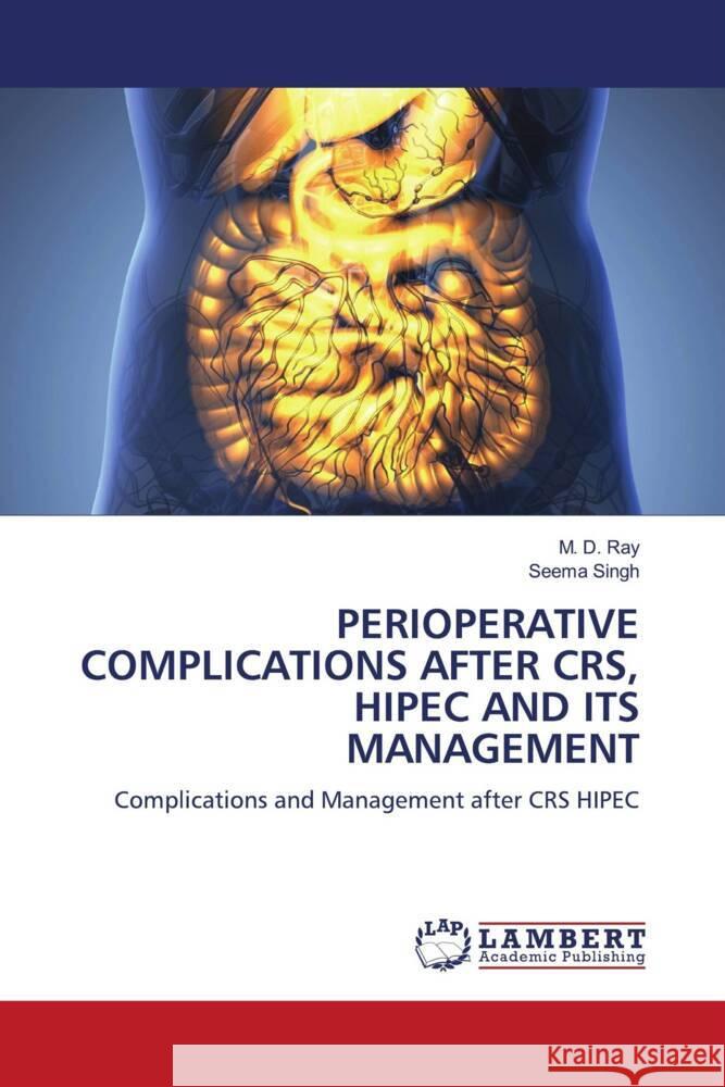 PERIOPERATIVE COMPLICATIONS AFTER CRS, HIPEC AND ITS MANAGEMENT Ray, M. D., Singh, Seema 9786204750941