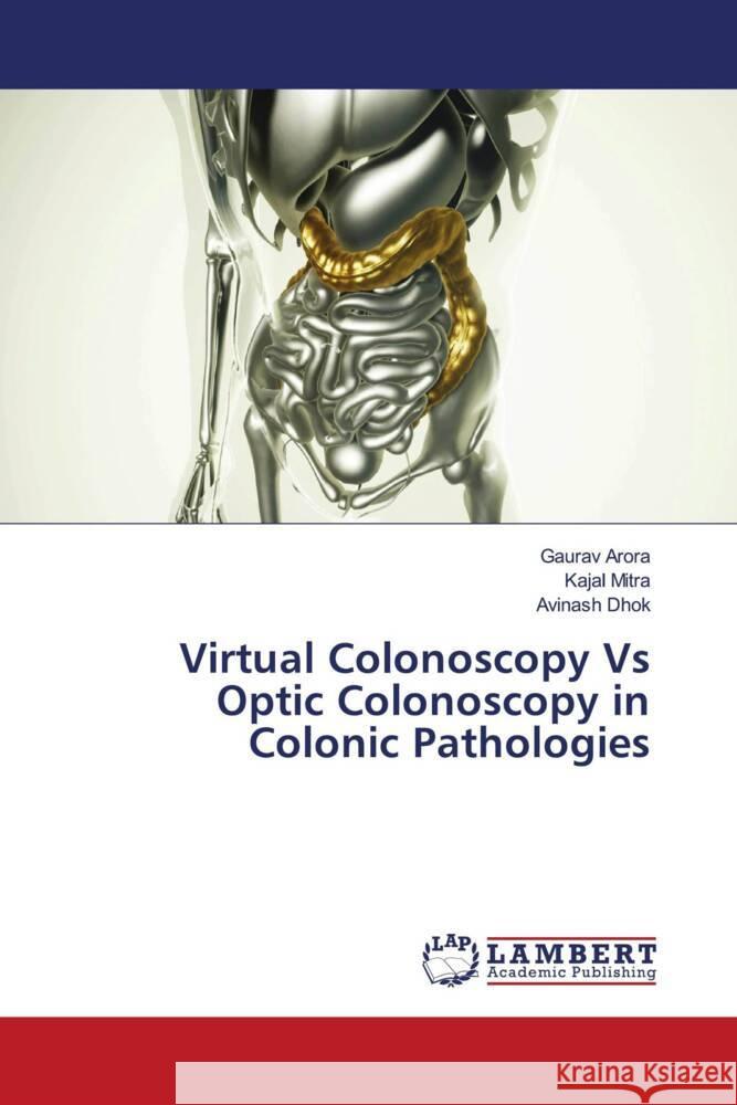 Virtual Colonoscopy Vs Optic Colonoscopy in Colonic Pathologies Arora, Gaurav, Mitra, Kajal, Dhok, Avinash 9786204752181