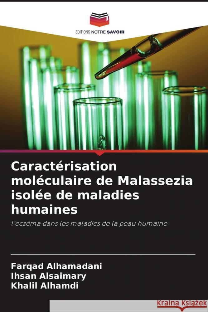 Caractérisation moléculaire de Malassezia isolée de maladies humaines Alhamadani, Farqad, Alsaimary, Ihsan Edan, Alhamdi, Khalil 9786204757513 Editions Notre Savoir