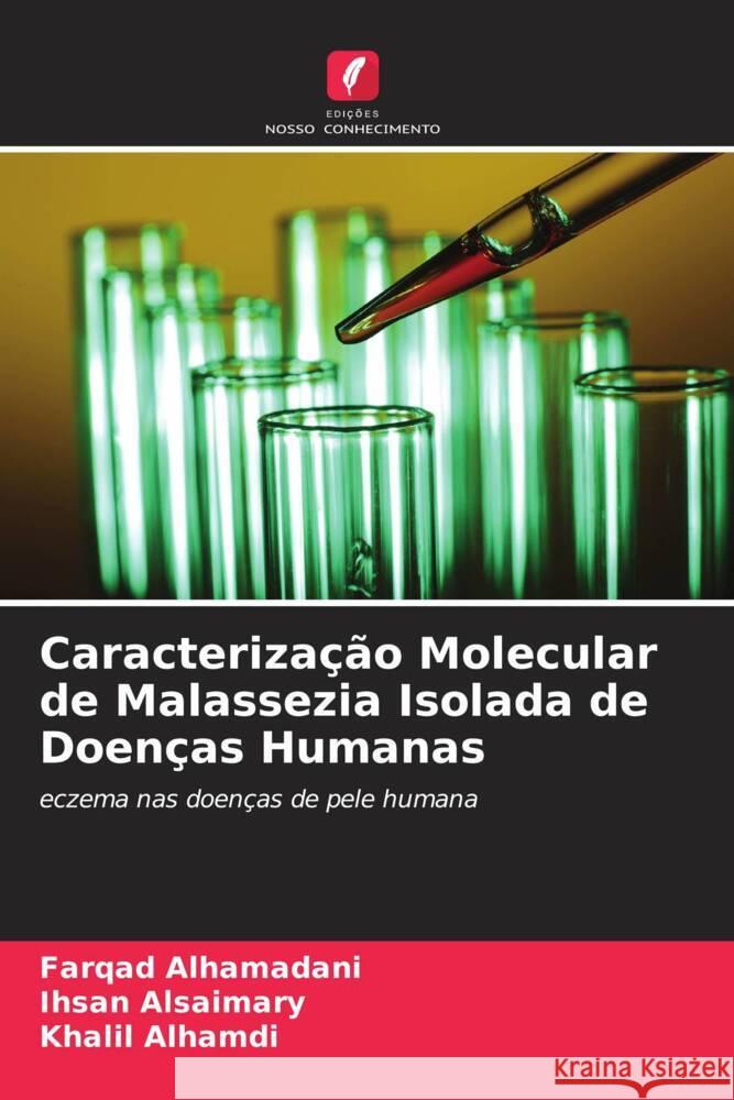 Caracterização Molecular de Malassezia Isolada de Doenças Humanas Alhamadani, Farqad, Alsaimary, Ihsan Edan, Alhamdi, Khalil 9786204757544 Edições Nosso Conhecimento