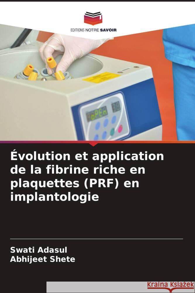 Évolution et application de la fibrine riche en plaquettes (PRF) en implantologie Adasul, Swati, Shete, Abhijeet 9786204758152 Editions Notre Savoir