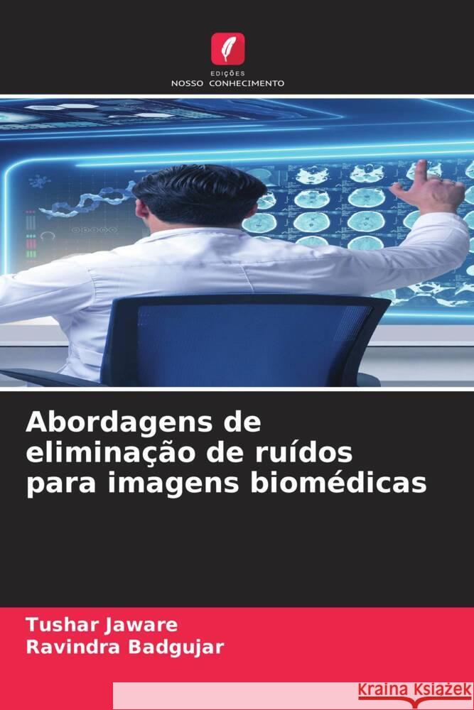 Abordagens de eliminação de ruídos para imagens biomédicas Jaware, Tushar, Badgujar, Ravindra 9786204762340