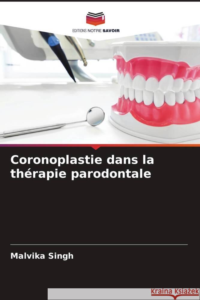 Coronoplastie dans la thérapie parodontale Singh, Malvika 9786204764030