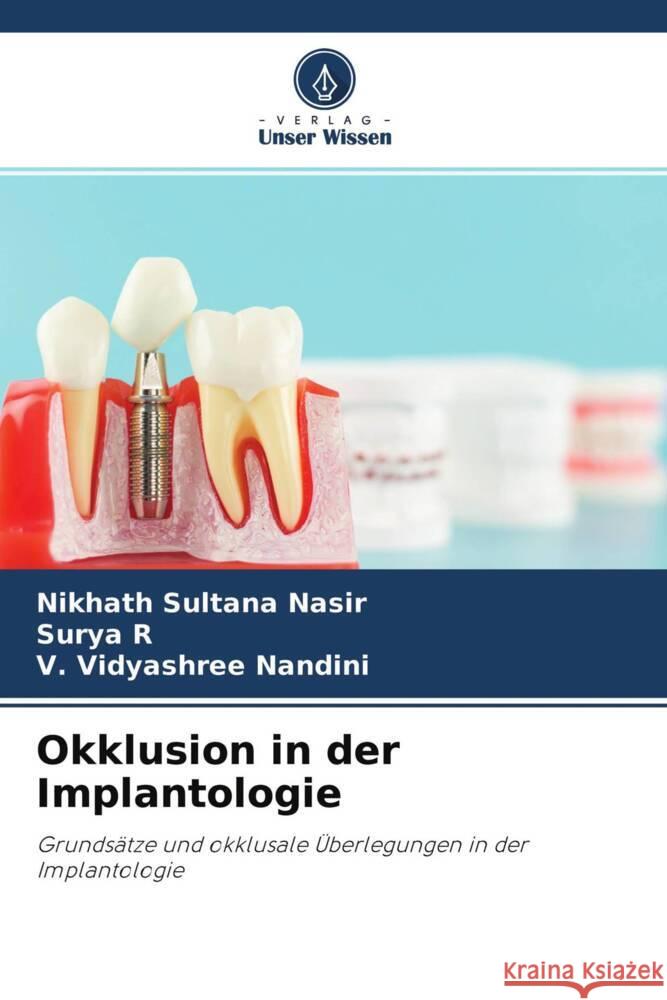 Okklusion in der Implantologie Sultana Nasir, Nikhath, R, Surya, Nandini, V. Vidyashree 9786204767390