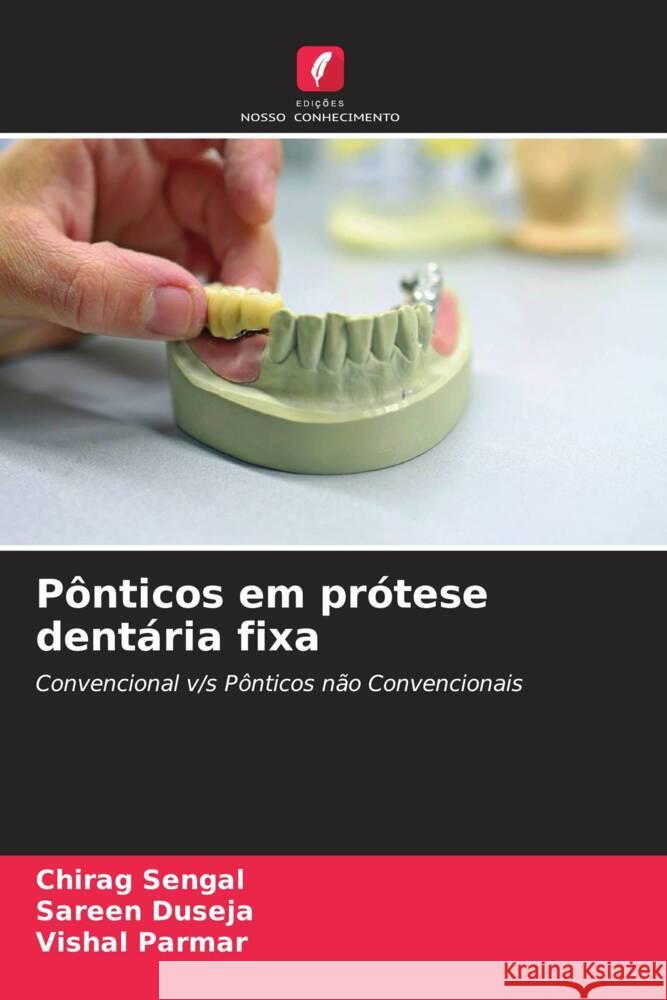 Pônticos em prótese dentária fixa Sengal, Chirag, Duseja, Sareen, Parmar, Vishal 9786204768663