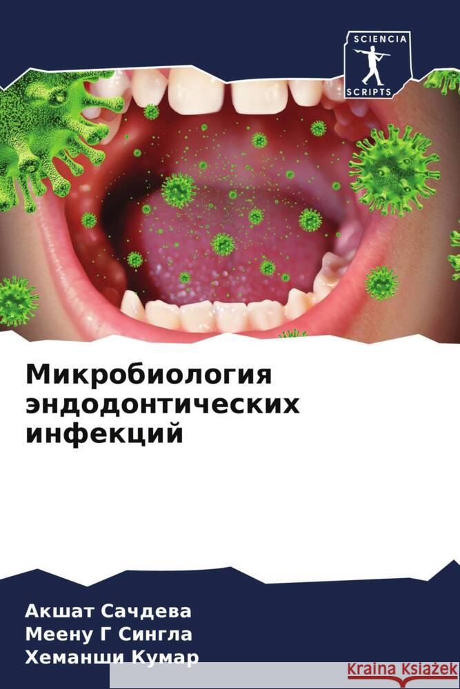 Mikrobiologiq ändodonticheskih infekcij Sachdewa, Akshat, Singla, Meenu G, Kumar, Hemanshi 9786204772431